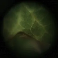 Présence des petits hommes verts