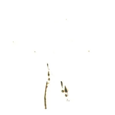 Légères brûlures