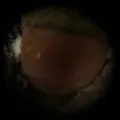 Gland