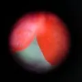 Cardiaque