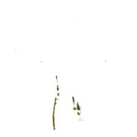 Légères brûlures